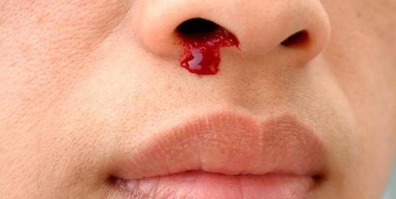 چطور خون دماغ را بند بیاوریم؟